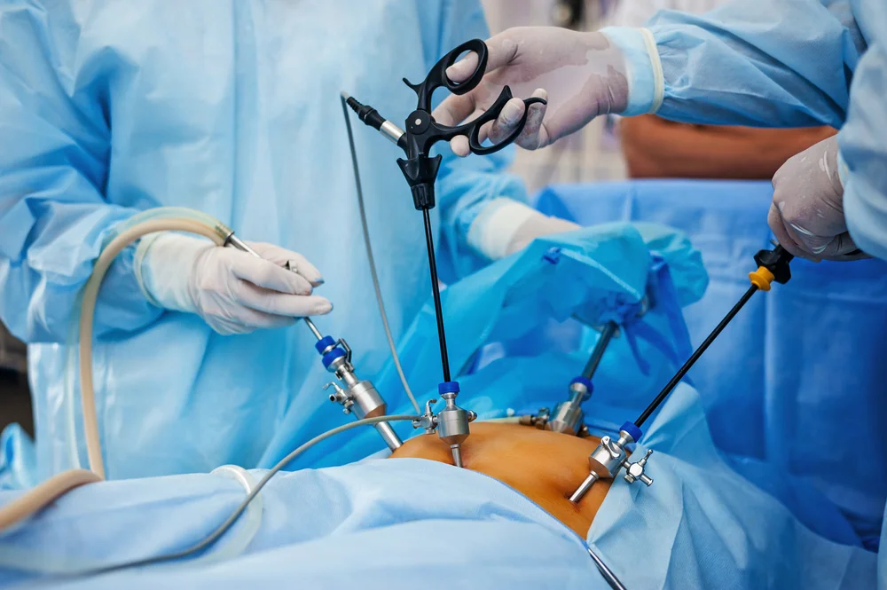 laparoscopic.webp